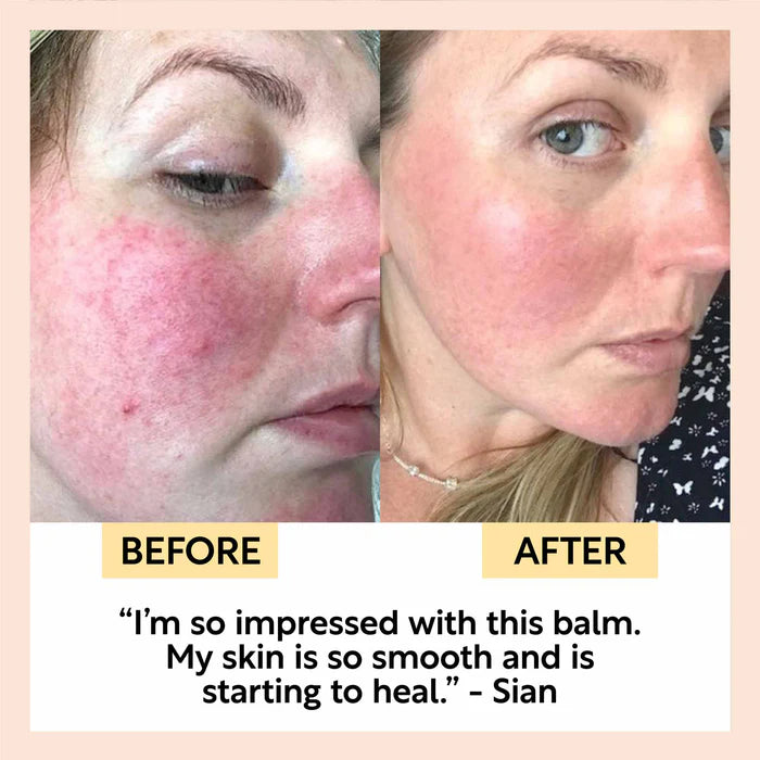 Cleanse, Tone + Moisturize Set