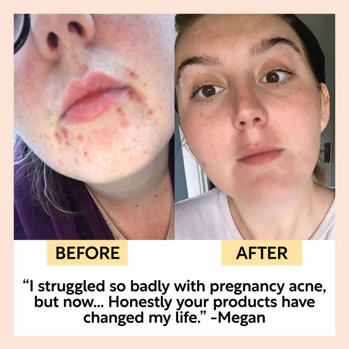 Cleanse, Tone + Moisturize Set